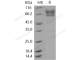 Recombinant Human Coagulation Factor IX/F9 Protein (His Tag)(Active)