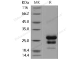 Recombinant Human CLEC4D/CLECSF8 Protein (His Tag)