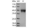 Recombinant Human IL-21R Protein (His Tag)(Active)