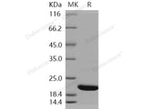 Recombinant Human CFL2/cofilin 2/ADF Protein (His Tag)