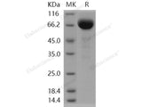 Recombinant Human EphA3 Protein (His Tag)(Active)