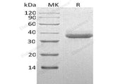 Recombinant Human Chymotrypsin C Protein (His Tag)(Active)