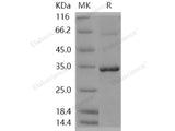 Recombinant Human NMNAT1/NMNAT Protein (His Tag)