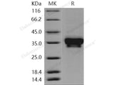 Recombinant Human STIM1/GOK Protein (His Tag)