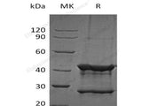 Recombinant Human UBE2D1 Protein (His Tag)