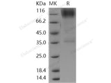 Recombinant Human B3GNT2 Protein (Fc Tag)