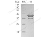 Recombinant Human SULT2A1 Protein (His Tag)