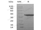 Recombinant Human SULT2B1 Protein (aa 2-365, His Tag)