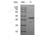 Recombinant Human SULT1A3 Protein (His Tag)(Active)