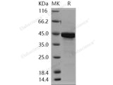 Recombinant Human PTMA Protein (GST Tag)