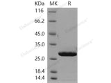 Recombinant Human CMBL Protein (His Tag)