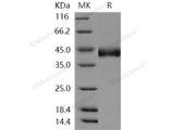 Recombinant Human CHST11/C4ST-1 Protein (His Tag)