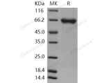 Recombinant Human FLRT1 Protein (His Tag)(Active)