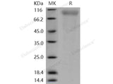 Recombinant Human CD180/RP105/LY64 Protein (His Tag)(Active)