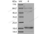 Recombinant Human Cochlin/COCH Protein (His Tag)