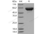 Recombinant Human ORP150/HSP12A Protein (His Tag)