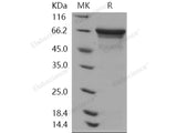 Recombinant Human HSPA8/HSC70 Protein (His Tag)