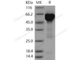 Recombinant Human HSPD1/HSP60 Protein (His & GST Tag)