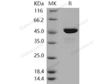 Recombinant Human SOCS3/CIS3 Protein (His & Trx Tag)