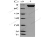 Recombinant Human EphA4 Protein (His & Fc Tag)(Active)