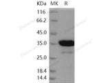 Recombinant Human SAA4 Protein (GST Tag)