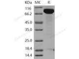 Recombinant Human EED/Embryonic Ectoderm Development Protein (His & GST Tag)