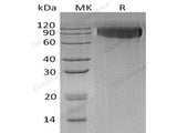 Recombinant Human GPNMB Protein (aa 1-474, His Tag)