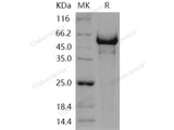 Recombinant Human Semaphorin 5A/SEMA5A Protein (aa 1-968, His Tag)