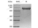 Recombinant Human FLRT2 Protein (His Tag)(Active)