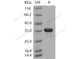 Recombinant Human AKR1B1 Protein (His Tag)