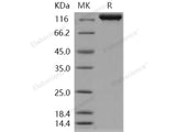 Recombinant Human IGSF3/EWI-3 Protein (His Tag)