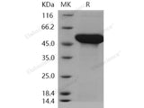 Recombinant Human ADSL/Adenylosuccinate Lyase Protein (His Tag)