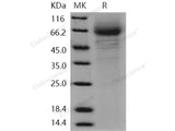 Recombinant Human CD97 Protein (His Tag)(Active)