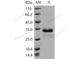 Recombinant Human SULT1E1/ST1E1 Protein (His Tag)