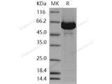 Recombinant Human ACOX1/aox Protein (His Tag)