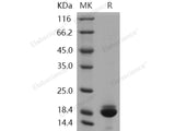 Recombinant Human PRDX5 Isoform cytoplasmic + peroxisomal Protein (His Tag)