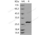 Recombinant Human Peroxiredoxin 2/PRDX2 Protein (His Tag)(Active)