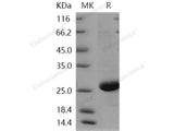 Recombinant Human CRP/C-Reactive Protein