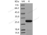 Recombinant Human PPM1G/PP2C-gamma Protein (aa 317-546, His Tag)