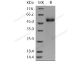 Recombinant Human ACPL2 Protein (His Tag)