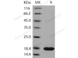 Recombinant Human REG3A/HIP Protein (His Tag)