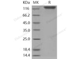 Recombinant Human OSMR/IL31RB Protein (aa 1-740, His Tag)