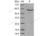 Recombinant Human DNMT2/TRDMT1 Protein (GST Tag)