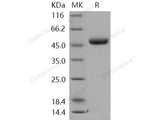 Recombinant Human Chitotriosidase/CHIT1 Protein (His Tag)