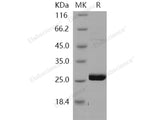 Recombinant Human METTL11A Protein