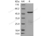 Recombinant Human METTL11A Protein (GST Tag)