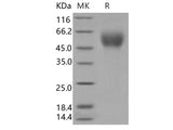 Recombinant Human CD200R1 Protein (His Tag)(Active)