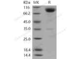 Recombinant Human CD200R1 Protein (His & Fc Tag)(Active)