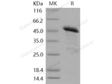 Recombinant Human PRDM2/RIZ1 Protein (GST Tag)