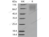 Recombinant Human LAMP1/CD107a Protein (His Tag)(Active)